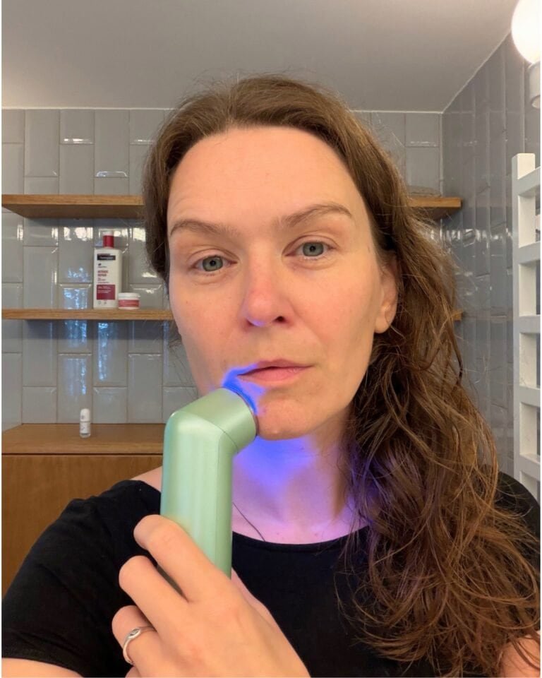 blue light wand nanoleaf used for hormonal acne